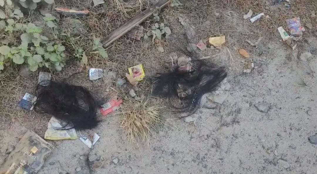 প্রাতঃভ্রমণে বেরিয়ে শিক্ষিকাকে কুপিয়ে খুনের চেষ্টা, আত্মঘাতী হওয়ার চেষ্টা অভিযুক্তের